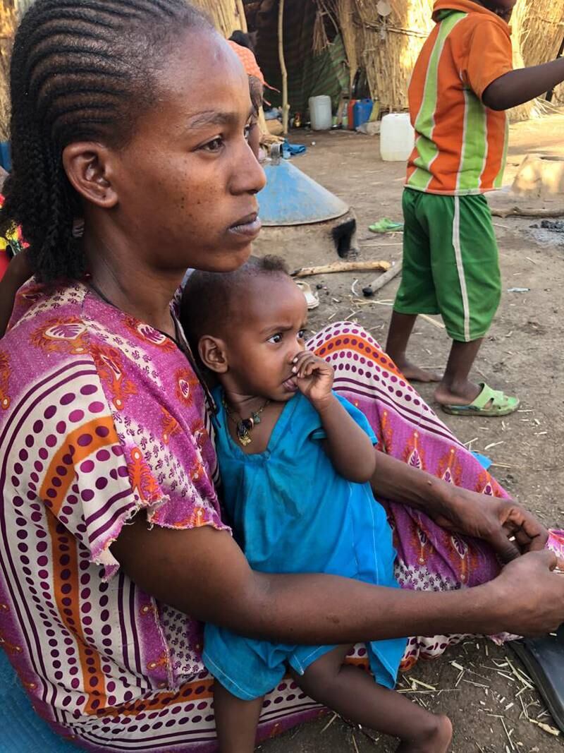 Tshaga, 27 year old woman and daughter Temnit 1 year (MAM) temoignage. Courtesy MSF