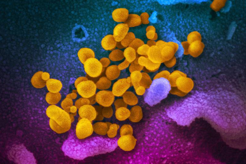 This undated electron microscope image made available by the U.S. National Institutes of Health in February 2020 shows the Novel Coronavirus SARS-CoV-2, yellow, emerging from the surface of cells, blue/pink, cultured in the lab. Also known as 2019-nCoV, the virus causes COVID-19. On Friday, April 3, 2020, The Associated Press reported on stories circulating online incorrectly asserting that eating alkaline foods will stave off the novel coronavirus, which has a pH level of 5.5 to 8.5. Donald Schaffner, extension specialist in food science at Rutgers University, told the AP. â€œThe human body is designed to be really good at maintaining its pH. â€¦ the best way to keep from getting a virus is to stay away from people.â€ (NIAID-RML via AP)