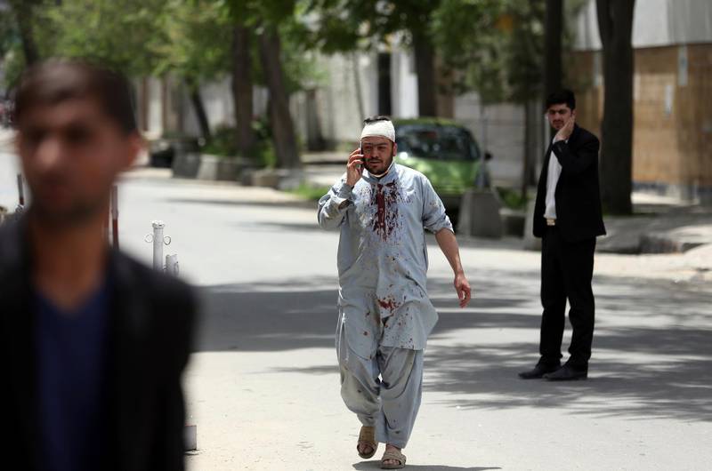 An Afghan injured man walks as he talks with his mobile cell phone after a huge explosion in Kabul, Afghanistan. AP Photo