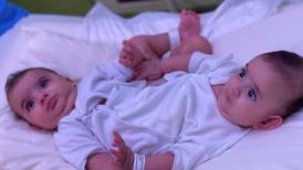 Surgeons prepare to separate conjoined Libyan twins
