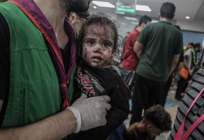 Scores of injured people were taken to Al-Shifa Hospital following an Israeli air strike on Al Ahli Hospital in Gaza city. Reuters