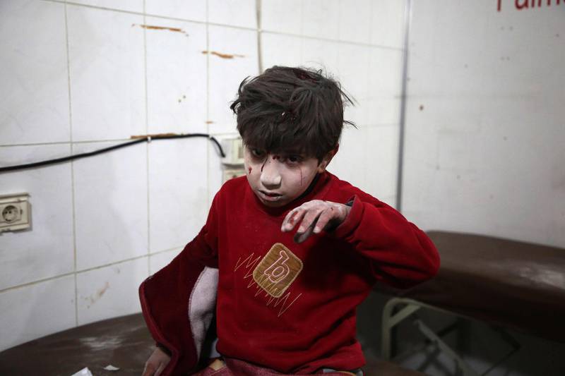 A wounded boy waits for treatment a make-shift hospital. Amer Almohibany / AFP Photo