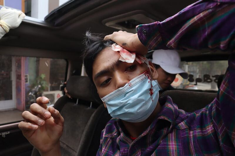 A wounded man holds a bandage to his bleeding head following a demonstration against the military coup where security forces fired on and beat protesters in Mandalay. AFP