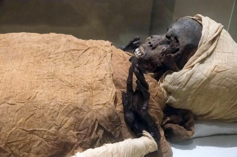 A CT scan of his mummy by Egypt’s Ministry of Antiquities suggests King Seqenenre Taa II was killed by blows to the head in the 16th century BC. EPA