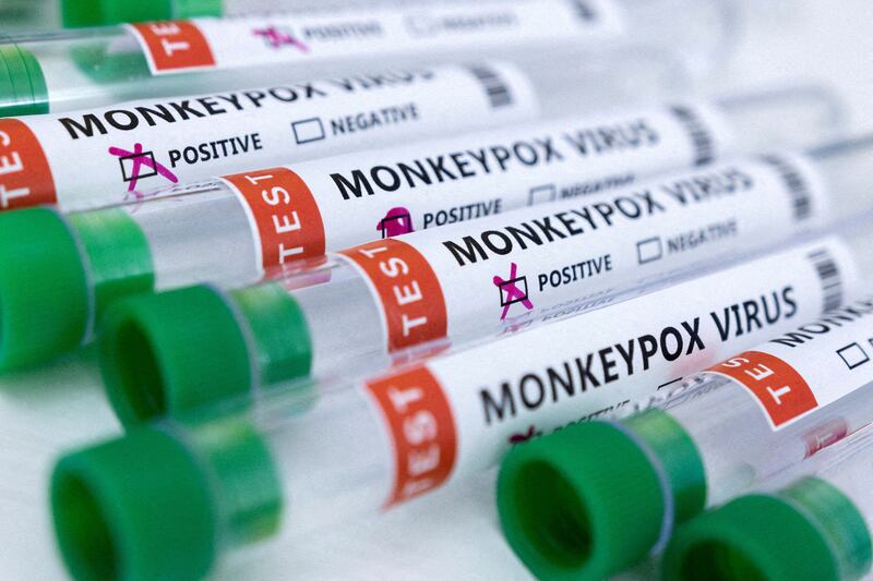 Monkeypox is spread through close skin-to-skin contact with an infected person, or by touching infected objects Photo: Reuters