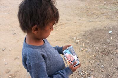 Malnourished boy Hassan Merzam Muhammad looks at a previous photo of him on a mobile phone as he stands near his family's hut in Abs district of Hajjah province, Yemen November 20, 2020. Picture taken November 20, 2020. REUTERS/Eissa Alragehi NO RESALES. NO ARCHIVES