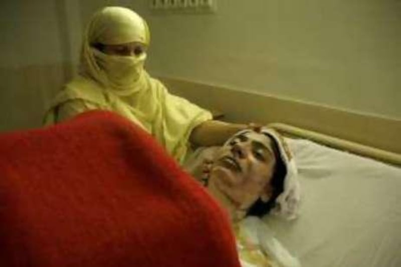 A hospital Nurse attends to the victim of domestic Violence in the Burns Unit of MAYO Emergency Hospital  .Domestic Violence Story, Lahore, Pakistan, by Matthew Tabaccos 11/11/08 *** Local Caption ***  11.Domestic Violence story, Lahore,Pakistan by Matthew Tabaccos for The National.jpg