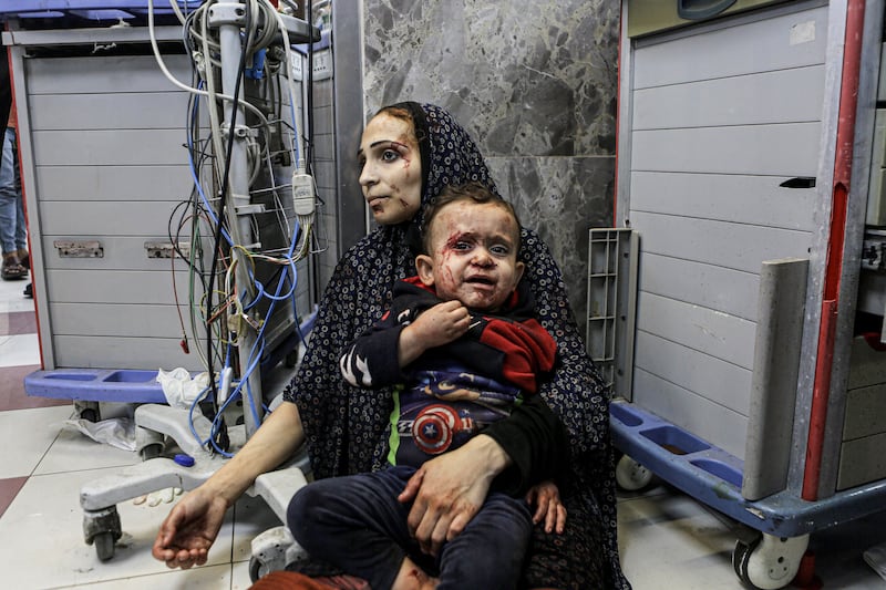 Wounded Palestinians wait for treatment. AP