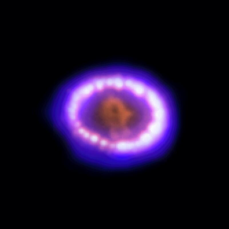 The Chandra X-ray image (left) reveals a ring of multimillion-degree gas produced by the collision of an outward-moving supernova shock wave with a ring of cool circumstellar gas. The optical image (right) from the Hubble Space Telescope shows a ring of bright spots that are also caused by the shock wave hitting the cool gas. Long before the explosion of the massive star that produced Supernova 1987A, most of its outer layers expanded away in a slowly moving stellar wind that formed a vast cloud of gas. Later, a high-speed wind from the star carved out a cavity about 1 light year in diameter in the cool gas cloud. As the supernova shock wave plows deeper into the cool cloud the ring should become larger and much brighter in both optical and X-ray light. 
