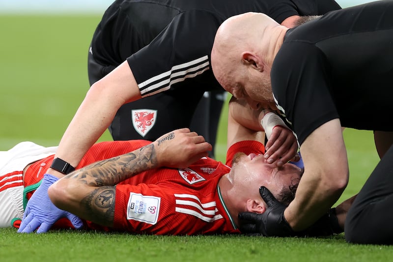 Williams is treated after being hit in the face by a Marcus Rashford shot. Getty 