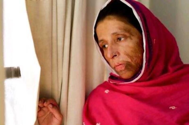 A scene from the documentary Saving Face featuring the 23-year-old acid attack victim Rukhsana. Asad Faruqi / HBO