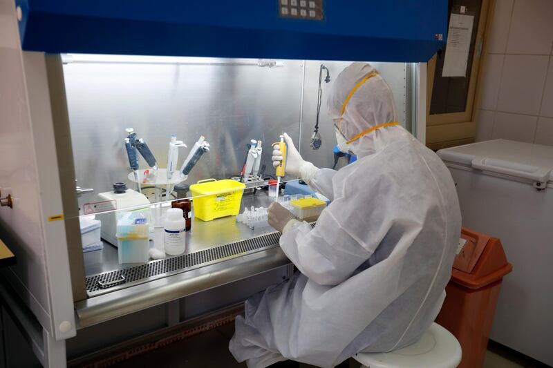 Lab technicians work on samples from suspected coronavirus patients at a laboratory in Sanaa, Yemen. EPA