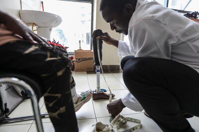 A Kenyan orthopaedic technologist Amos Wafula assists to fit a young boy with a 3D printed prosthetic in Nairobi last month. EPA