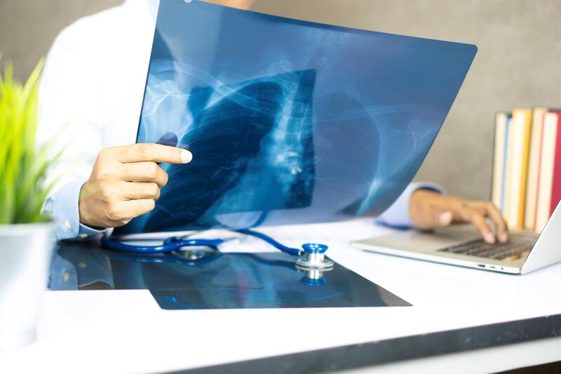 Doctor examining chest x-ray film of patient at hospital