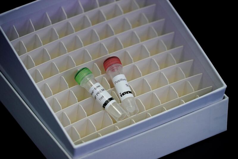 Samples of iLAMP Novel-Coronavirus Detection Kit are seen during a demonstration at an iONEBIO's office in Seongnam. Reuters