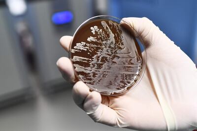 A scientist shows bacteria that are cultivated at the laboratory of the centre of research on infectious diseases of the University Hospital Institute (IHU) Mediterranean Infection, in Marseille, on March 29, 2018.
Marseille has inaugurated a research centre on infectious diseases, complete with insect breeding, a bacteria bank and hospital rooms for highly infectious patients. This project, launched in 2011, required 100 million euros of investment and aims at fighting infectious diseases, the leading cause of death in the world, killing 17 million people per year. / AFP PHOTO / ANNE-CHRISTINE POUJOULAT