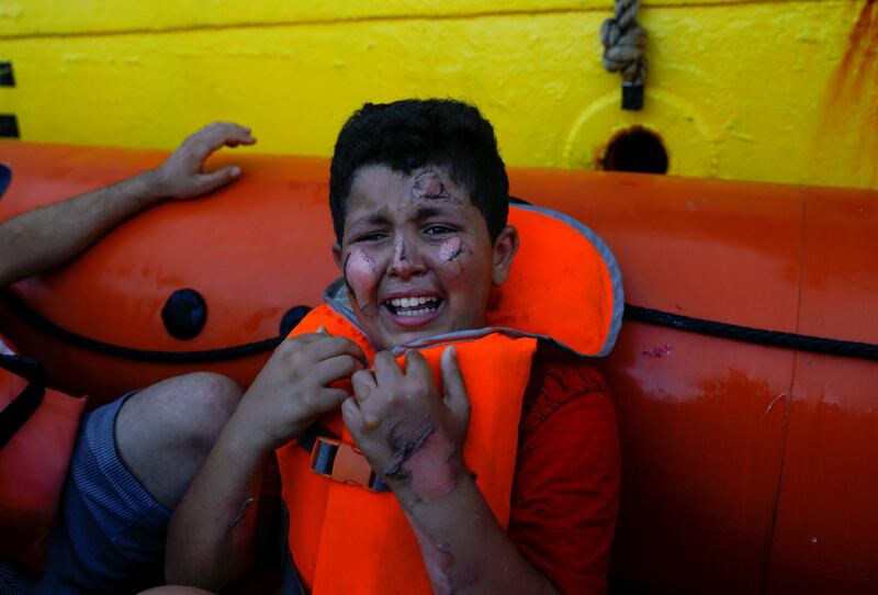 A migrant boy with fuel burns on his face and hand sits in a boat operated by the ‘​Sea-Watch 3’