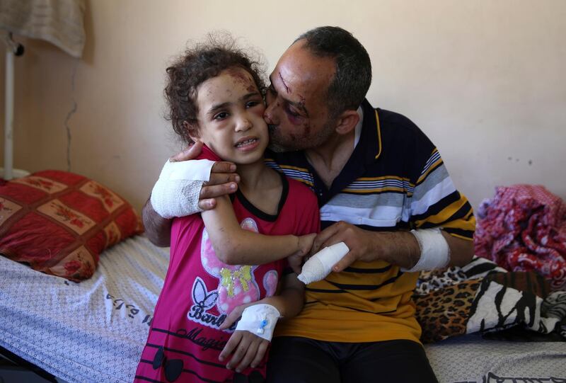 Suzy Ishkontana, 7, is kissed by her father Riad Ishkontana, 42, at Shifa Hospital in Gaza City, Tuesday, May 18, 2021. Suzy and her father Riad were the only survivors of their family after an Israeli airstrike destroyed one of the buildings they lived in in Gaza City early Sunday, killing her mother and four siblings. The man and his daughter were pulled alive from under the rubble after several hours. (AP Photo/Abdel Kareem Hana)