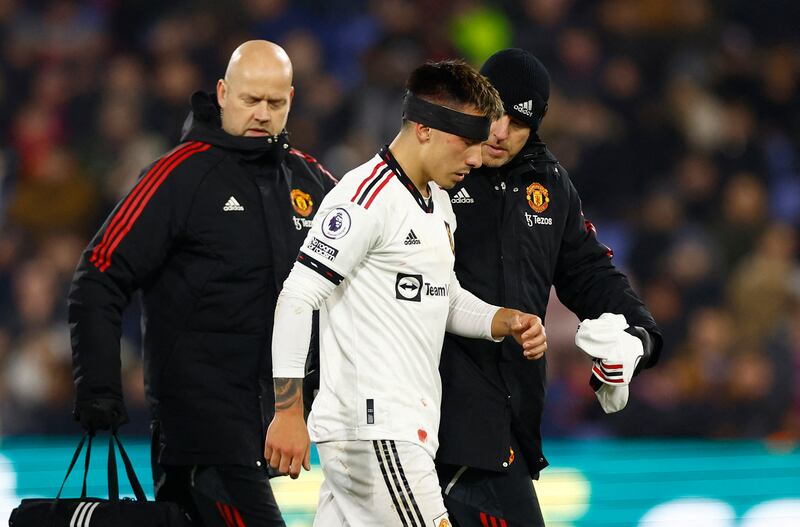 United's Lisandro Martinez wears a head band after receiving medical attention. Action Images