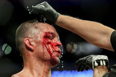 NEW YORK, NEW YORK - NOVEMBER 02: Nate Diaz of the United States has blood washed off his face during the Welterweight "BMF" championship bout against Jorge Masvidal of the United States in UFC 244 at Madison Square Garden on November 02, 2019 in New York City. Steven Ryan/Getty Images/AFP == FOR NEWSPAPERS, INTERNET, TELCOS & TELEVISION USE ONLY ==