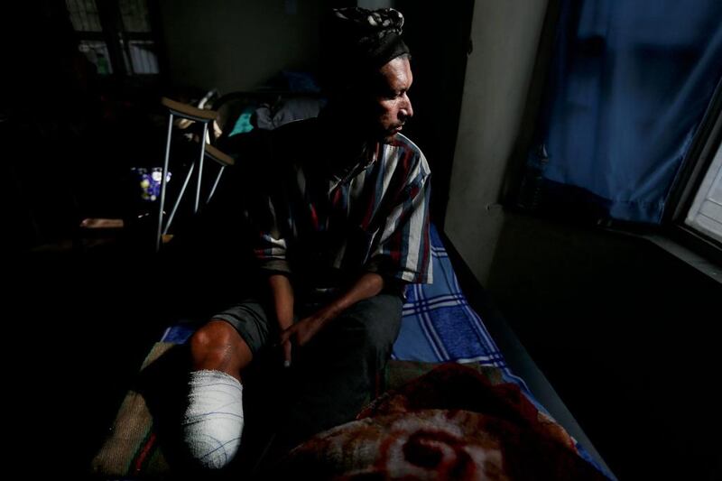 Bishnu Bahadur Karki, 42, looks on as he is sits in an Orthopedic rehabilitation center in Kathmandu, Nepal. Narendra Shrestha / EPA