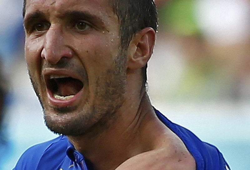 Giorgio Chiellini shows off his shoulder as he appeals to officials after claiming he was bitten by Luis Suarez on Tuesday at the 2014 World Cup. Tony Gentile / Reuters / June 24, 2014