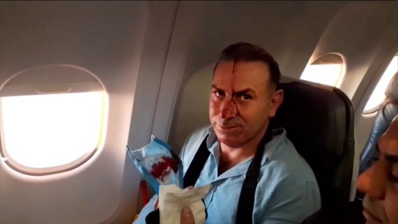 An image grab from a video released by state-run Iran Press news agency on July 24, 2020, reportedly shows a passenger with blood dripping on his face, on an Iranian passenger plane after it was intercepted by a US F-15 while flying over Syria. The US said it had intercepted an Iranian passenger plane as it flew over Syria, after Iranian state television accused Israel of being behind the encounter. The US statement came after an IRIB television channel report aired amateur footage of people on board screaming as the Mahan Air jetliner appeared to change course suddenly, leading to injuries among passengers. - RESTRICTED TO EDITORIAL USE - MANDATORY CREDIT - AFP PHOTO / HO / IRAN PRESS" NO MARKETING NO ADVERTISING CAMPAIGNS - DISTRIBUTED AS A SERVICE TO CLIENTS FROM ALTERNATIVE SOURCES, AFP IS NOT RESPONSIBLE FOR ANY DIGITAL ALTERATIONS TO THE PICTURE'S EDITORIAL CONTENT, DATE AND LOCATION WHICH CANNOT BE INDEPENDENTLY VERIFIED  - NO RESALE - NO ACCESS ISRAEL MEDIA/PERSIAN LANGUAGE TV STATIONS/ OUTSIDE IRAN/ STRICTLY NI ACCESS BBC PERSIAN/ VOA PERSIAN/ MANOTO-1 TV/ IRAN INTERNATIONAL
 / AFP / IRAN PRESS / - / RESTRICTED TO EDITORIAL USE - MANDATORY CREDIT - AFP PHOTO / HO / IRAN PRESS" NO MARKETING NO ADVERTISING CAMPAIGNS - DISTRIBUTED AS A SERVICE TO CLIENTS FROM ALTERNATIVE SOURCES, AFP IS NOT RESPONSIBLE FOR ANY DIGITAL ALTERATIONS TO THE PICTURE'S EDITORIAL CONTENT, DATE AND LOCATION WHICH CANNOT BE INDEPENDENTLY VERIFIED  - NO RESALE - NO ACCESS ISRAEL MEDIA/PERSIAN LANGUAGE TV STATIONS/ OUTSIDE IRAN/ STRICTLY NI ACCESS BBC PERSIAN/ VOA PERSIAN/ MANOTO-1 TV/ IRAN INTERNATIONAL
