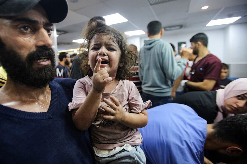 An injured toddler awaits treatment at the emergency ward of Al-Shifa Hospital following an Israeli strike, in Gaza city. AFP