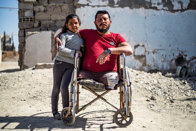 Ahmad Hajj Hmaidy, 36, lost his legs in a 2017 landmine explosion in Raqa, Syria, that also injured his daughter Nada, nine. AFP