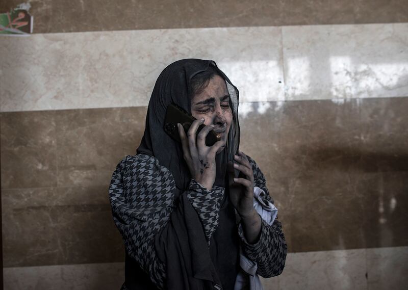 An injured woman speaks on the phone at Nasser Hospital in Khan Younis, following Israeli air strikes in the besieged southern Gaza Strip. EPA
