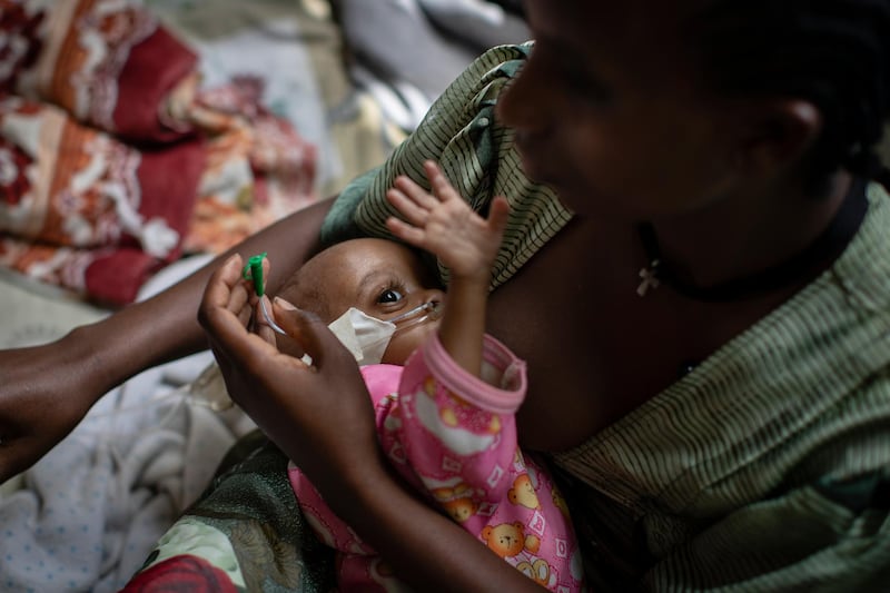 Birhan Etsana, 27, from Dengelat, uses a nasogastric tube to feed her malnourished baby, Mebrhit, who at 17 months old weighs just 5.2 kilograms (11 pounds and 7 ounces), at the Ayder Referral Hospital in Mekele, in the Tigray region of northern Ethiopia. AP Photo