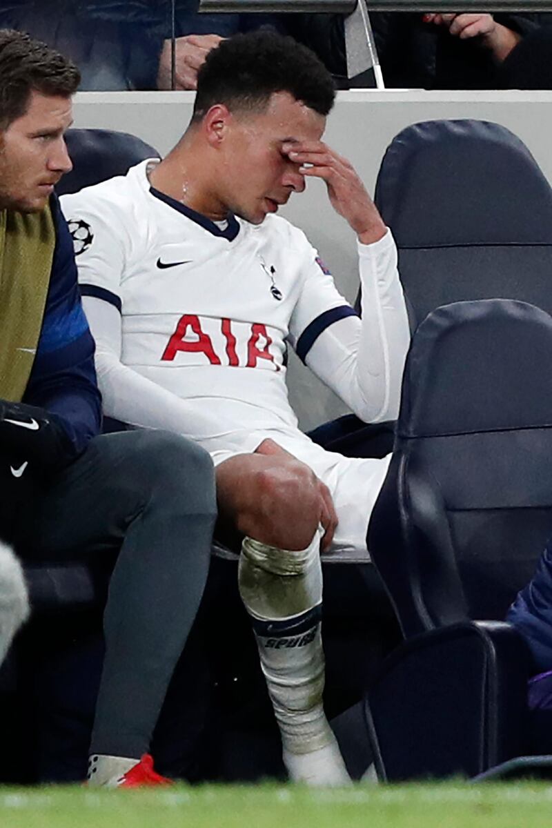 Dele Alli on the bench after coming off. AFP
