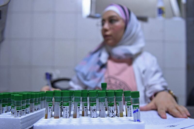 A lab technician works on samples to test for cholera at a hospital in Aleppo. AFP
