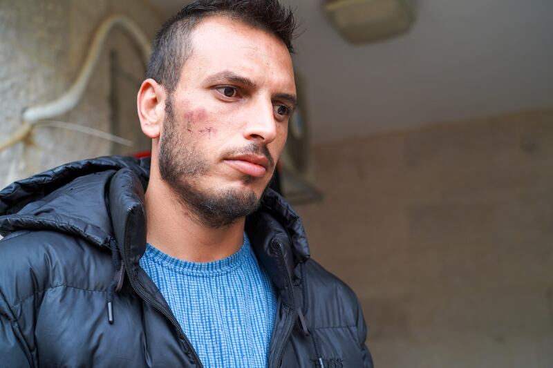 Akram Jundiye, 30, said Israel forces beat him before expelling him to the West Bank. Willy Lowry / The National