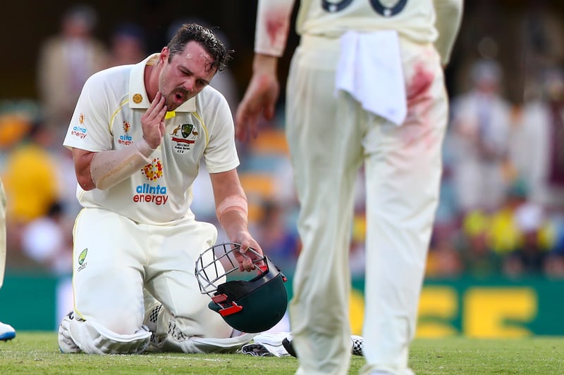 Australia's Travis Head reacts after he was hit in the face while batting. AP Photo