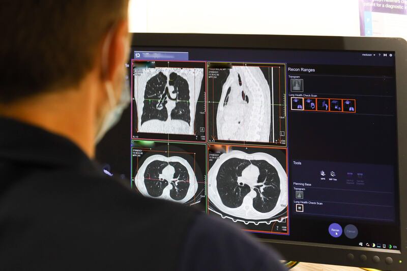 A health worker looks at the results of a lung scan, part of the NHS Targeted Lung Health Check Programme. PA