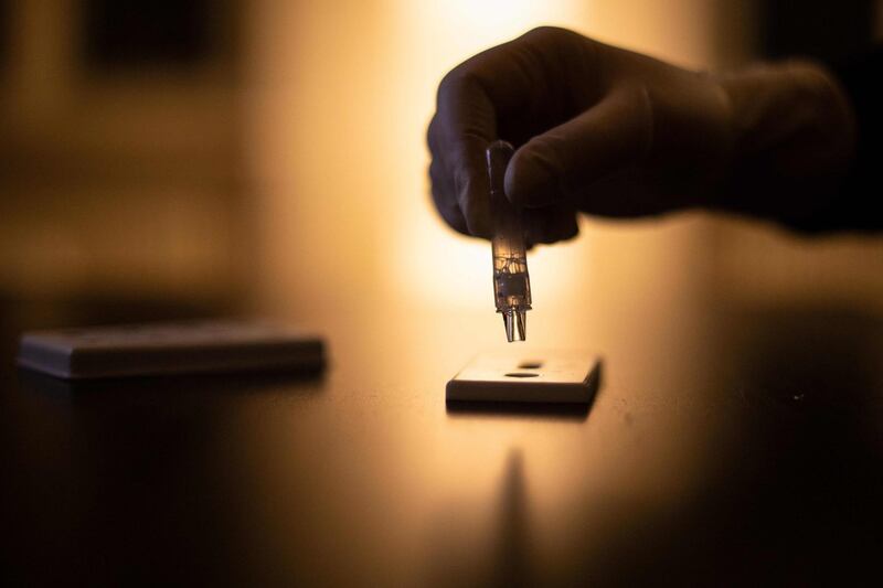 A person adds drops of a sample to the test device for a Covid-19 antigen rapid test in Berlin, Germany. AFP