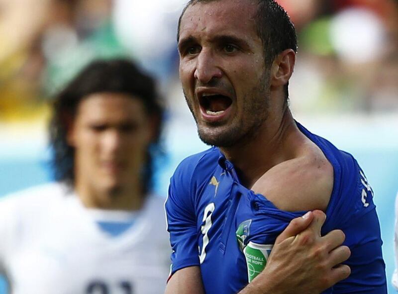 Italy's Giorgio Chiellini offers his shoulder as evidence that he has been bitten by Luis Suarez, unseen, during Italy and Uruguay's match at the 2014 World Cup on Tuesday. Tony Gentile / Reuters 