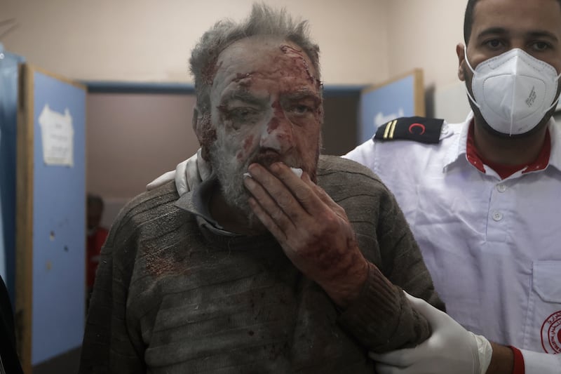 A Palestinian man injured in an Israeli strike receives treatment in Khan Younis, southern Gaza. AP