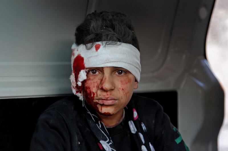 EDITORS NOTE: Graphic content / TOPSHOT - A wonded Syrian child sits inside a vehicle as he is evacuated from the scene of a pro-regime forces air strike in the town Maarrat Misrin in Syria’s northwestern Idlib province, on February 25, 2020. / AFP / Abdulaziz KETAZ
