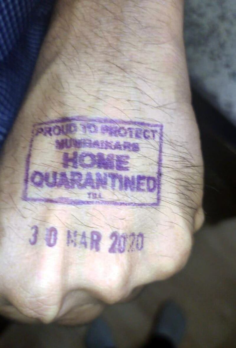 An Indian man shows his stamped hand, indicating that the person is under 'home quarantine', in Mumbai, India. EPA