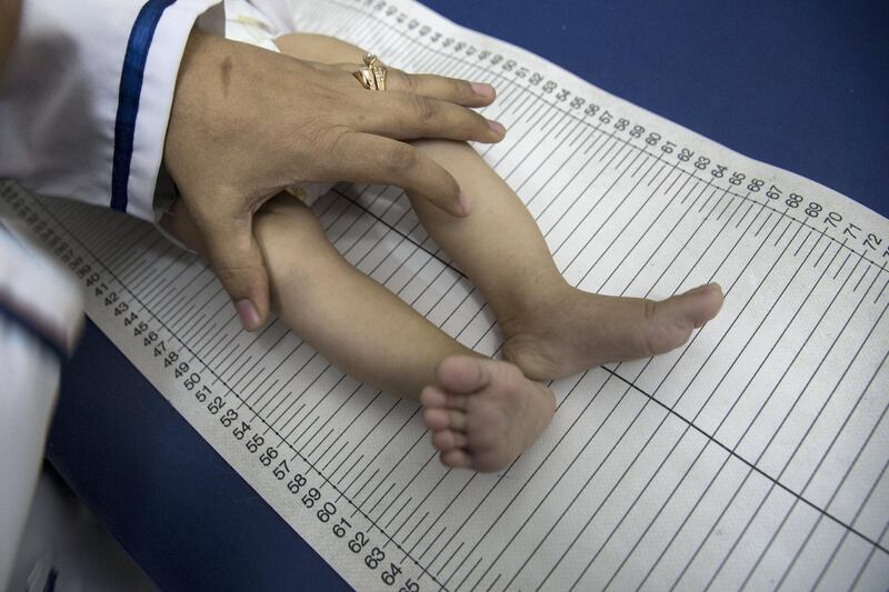 Palestinian nurse Sahar Swelhan measures 6-month-old baby girl Reham Menawi's height during her check up to monitor her weight and growth progress at the Ard El Insan clinic in Gaza City on October 28,2018. She is suffering from severe malnutrition and moderate Amemia and is   2 kilos under weight for a child her age. (Photo by Heidi Levine for The National).