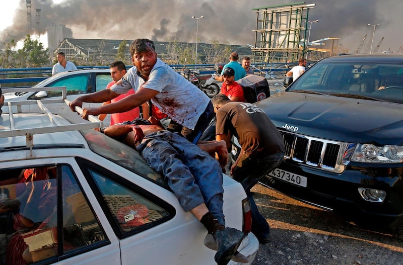 -- AFP PICTURES OF THE YEAR 2020 --

An injured man lies at the back of a car before being rushed away from the scene of a massive explosion at the port of Lebanon's capital Beirut on August 4, 2020. Two huge explosion rocked the Lebanese capital Beirut, wounding dozens of people, shaking buildings and sending huge plumes of smoke billowing into the sky. Lebanese media carried images of people trapped under rubble, some bloodied, after the massive explosions, the cause of which was not immediately known.
 - 
 / AFP / Marwan TAHTAH
