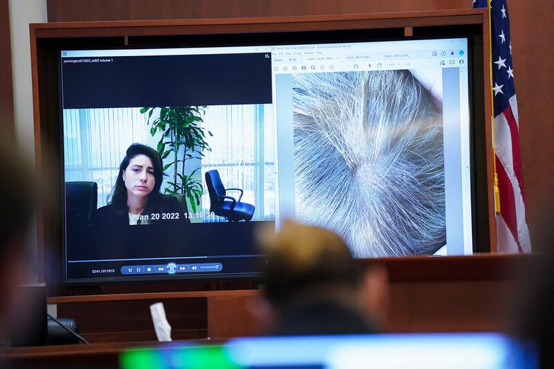 Pennington testifies about seeing the spot on Heard's head, which was bloodied and bare. AP 