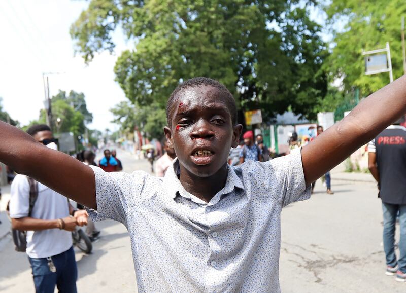 A demonstrator injured during the nationwide strike. Reuters