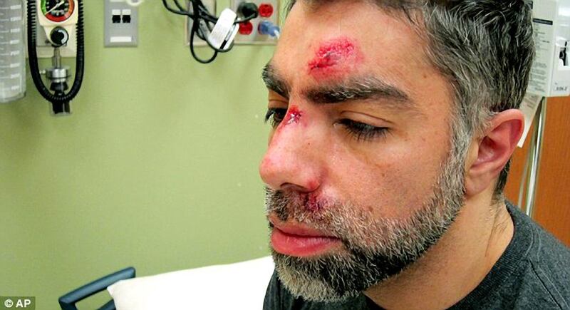 Filmmaker Usama Alshaibi claims he was beaten by a group of men who called him racial epithets after he wandered uninvited into an Iowa house party. Courtesy Usama Alshaibi / AP