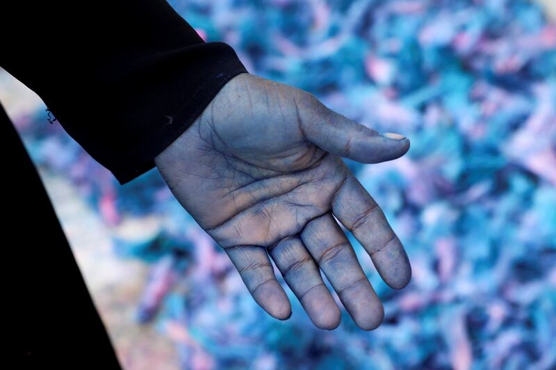Working in Egypt's informal feather industry often results in discoloured hands.