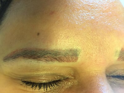 Candice Watson, permanent make-up removal and corrections specialist, shares an image of a client who came in with 'a double row of eyebrows in shades of green and purple'