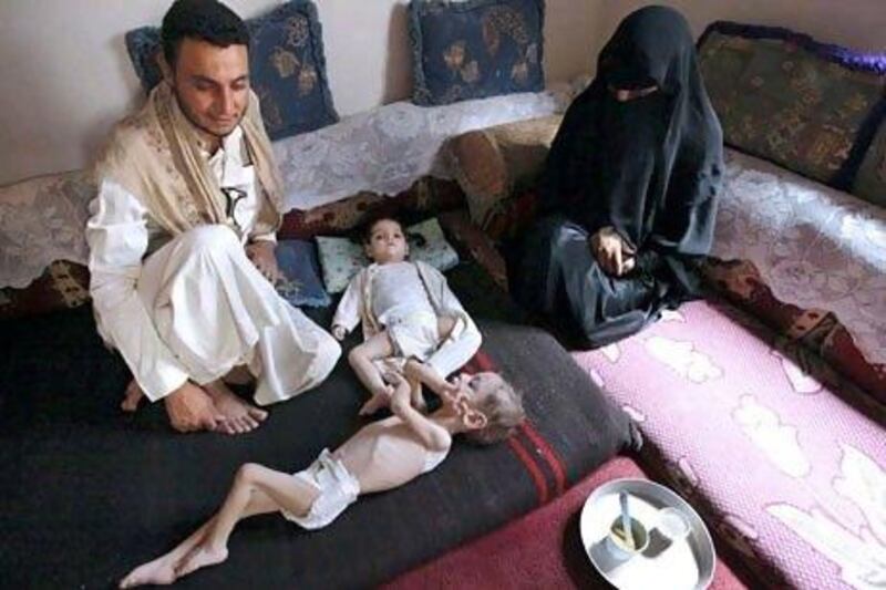 A family with a malnourished child at home in Sanaa. The United Nations says Yemen’s food and hunger crisis is one of the world’s worst and that the country is on the brink of disaster.