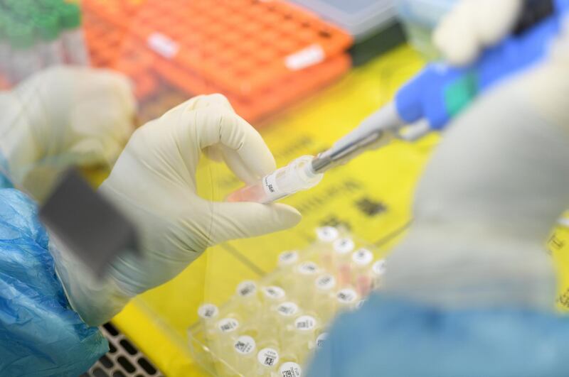 epa08199489 A staffer works in the pop-up Huoyan Laboratory specialized in the nucleic acid test on the novel coronavirus (2019-nCoV) in Wuhan, Hubei province, China, 06 February 2020 (issued 07 February 2020). The P2-level biosafety lab was built in five days, designed to perform 10,000 coronavirus tests per day to cope with the outbreak. The virus, which originated in the Chinese city of Wuhan, has so far killed at least 638 people and infected over 31,000 others, mostly in China.  EPA/SHEPHERD ZHOU CHINA OUT